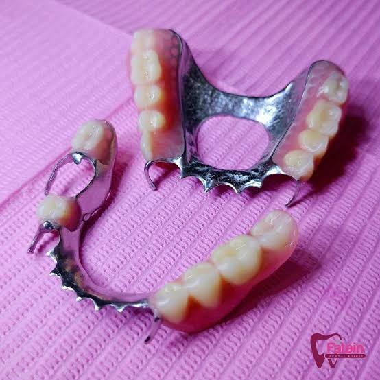 Gigi Tiruan Frame Logam Yaki Dental