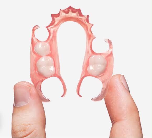 Gigi Tiruan Valplast Fleksibel